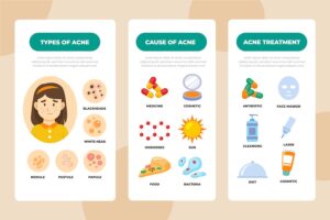 Banner image of Premium Hand Drawn Acne Oily Skin Problems Infographic  Free Download