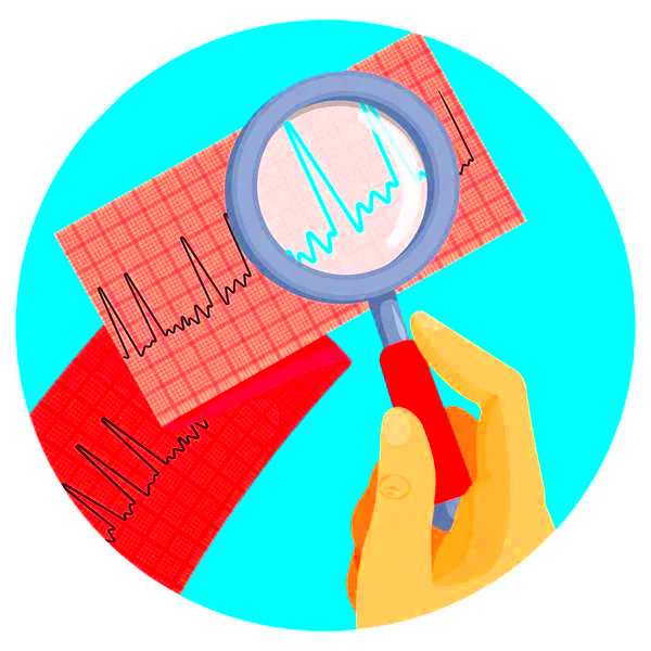 47 Atrial fibrillation Vector Images  Depositphotos