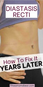 3 Steps On How To Fix Diastasis Recti Years Later