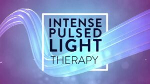 Intense Pulsed Light IPL Treatment  YouTube